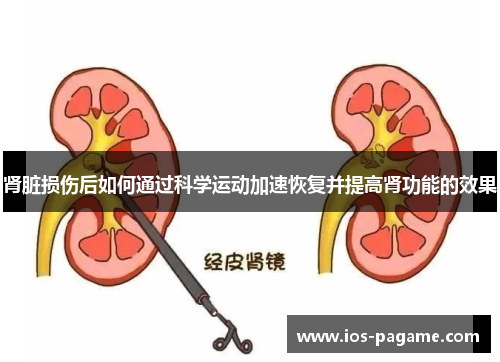 肾脏损伤后如何通过科学运动加速恢复并提高肾功能的效果